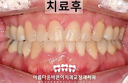 수술후