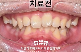 수술전