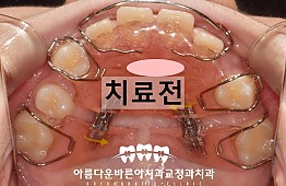 수술후