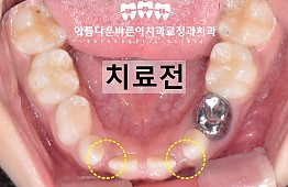 수술전