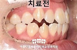 수술전