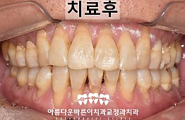 수술후