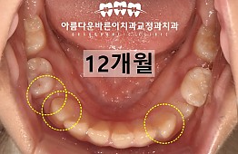 수술후