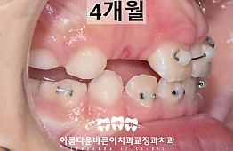 수술후