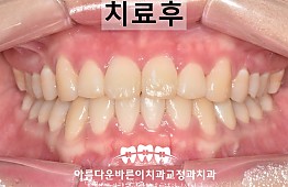 수술후