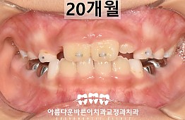 수술후