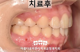 수술후