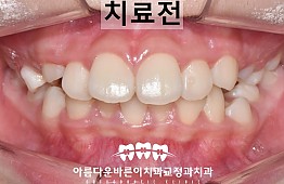 수술전