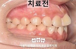 수술전