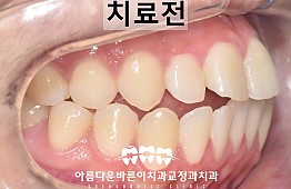 수술전