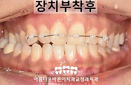 수술후