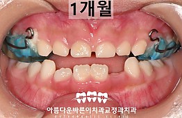 수술후