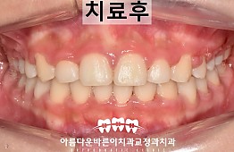 수술후