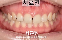 수술전