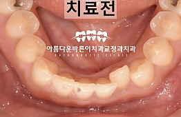 수술전