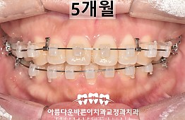수술후