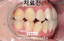 수술전