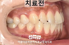 수술전