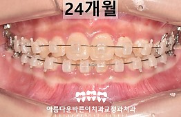 수술후