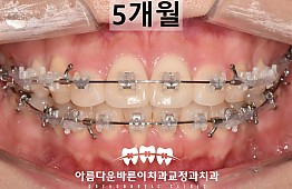 수술후