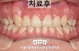 수술후