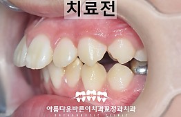 수술전