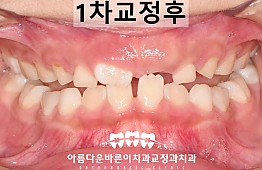수술후