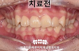 수술전