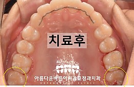 수술후