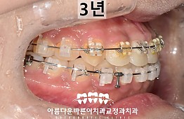 수술후