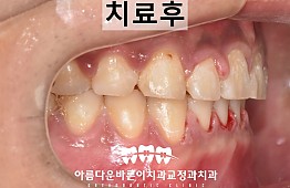 수술후