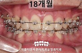 수술후