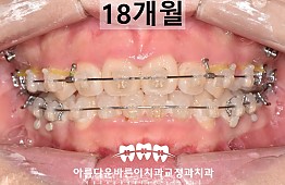 수술후
