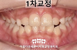 수술후