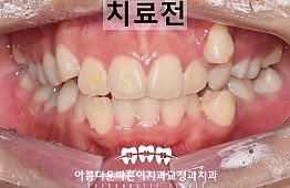 수술전