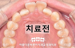 수술전