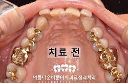 수술전