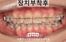 수술후