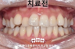 수술전