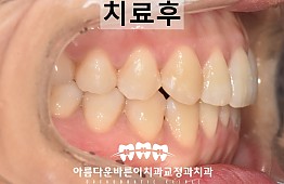 수술후