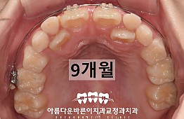 수술전