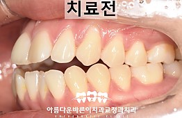 수술전