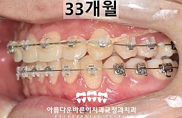 수술후