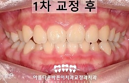 수술후