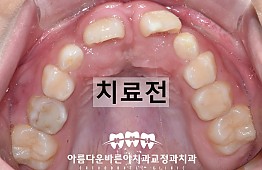 수술전