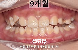 수술후