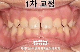 수술후