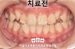수술전