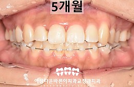 수술후