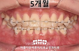 수술후